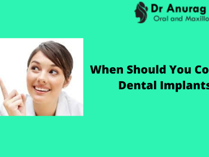 When Should You Consider Dental Implants?