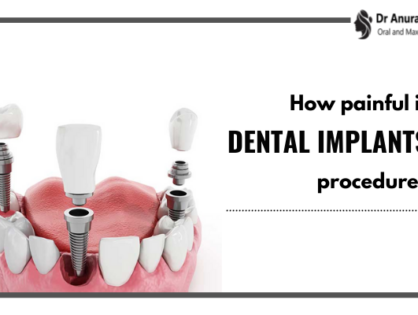 How painful is dental implants procedure? Know from the top dental surgeon