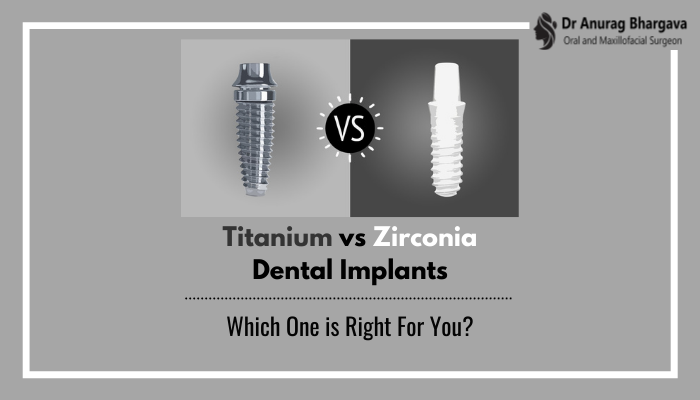 Titanium vs Zirconia Dental Implants: Which One is Right For You?