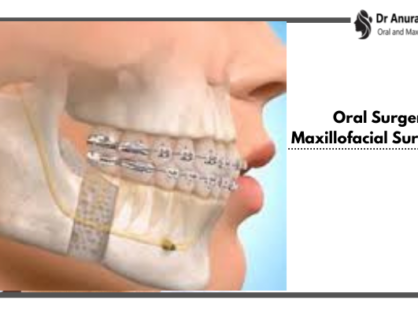 Oral and Maxillofacial Surgery - Unveiling the Surgeries