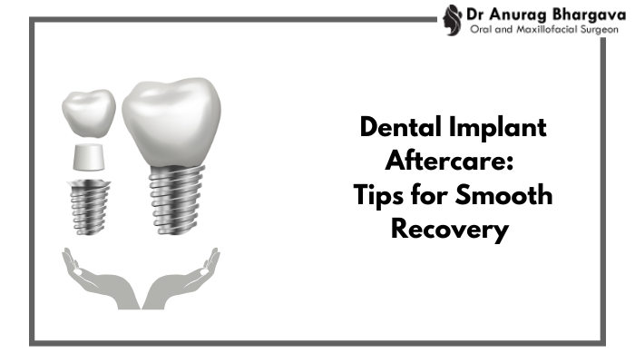 Dental Implant Aftercare: Tips for a Smooth Recovery and Long-Lasting Results