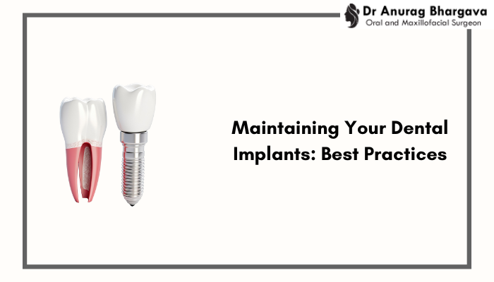 Maintaining Your Dental Implants: Best Practices