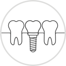 representation of Dental Implant