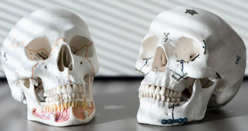 Jaw fractures and its treatment plan