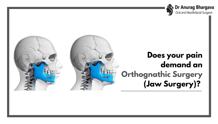 Does your pain and discomfort demand an Orthognathic Surgery?