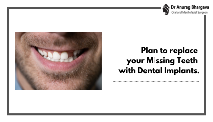 Plan to replace your missing teeth with dental implants.