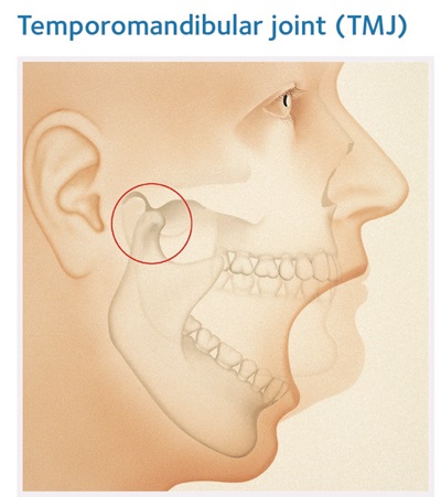 TMJ is the pain in jaw structure