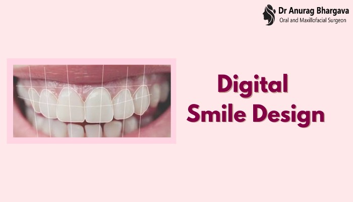 Digital Smile Design - The Complete Procedure by Top Dental Surgeon