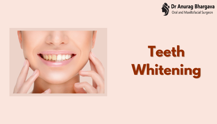 Teeth Whitening Cost - Procedure, Risks and Options