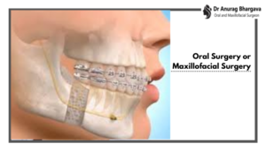 Oral Surgery And Maxillofacial Surgery