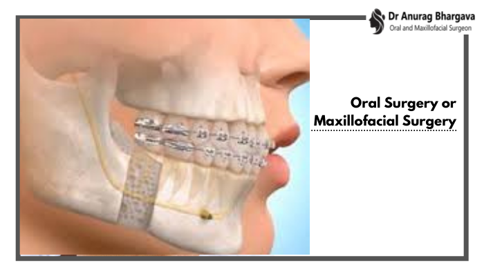 What Is Oral Surgery And Maxillofacial Surgery?