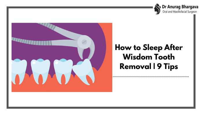 9 Tips | How to Sleep After Wisdom Tooth Removal