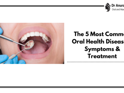 The 5 Most Common Oral Health Diseases | Symptoms & Treatment
