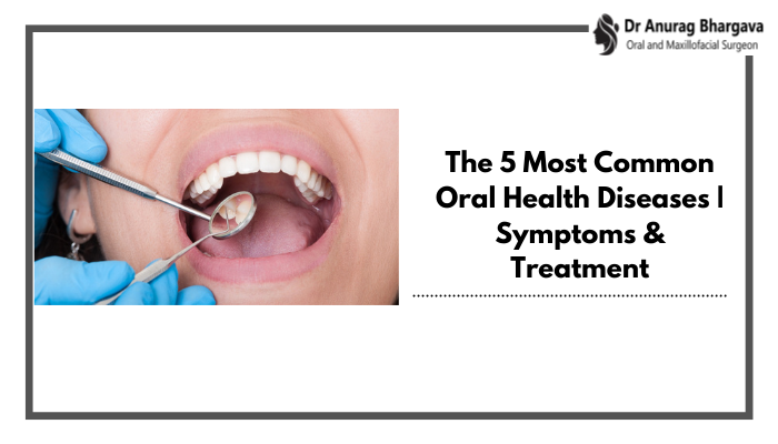 The 5 Most Common Oral Health Diseases | Symptoms & Treatment