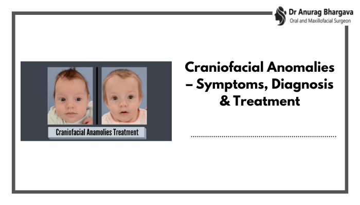 Craniofacial Anomalies - Symptoms, Diagnosis & Treatment