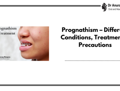 Prognathism - Different Conditions, Treatment & Precautions