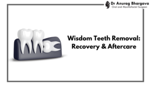 Wisdom Teeth Removal - Recovery and Aftercare by Dr. Anurag Bhargava