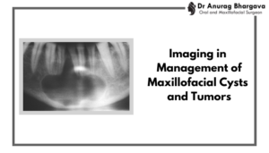 Role of Imaging in Management of Maxillofacial Cysts and Tumors by Best Maxillofacial Surgeon in Indore