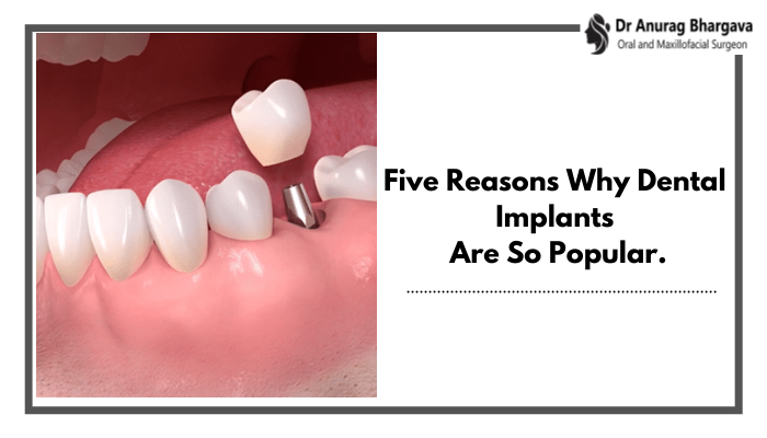 Five Reasons Why Dental Implants Surgery Is So Popular