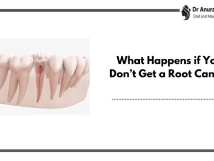 What Happens if You Don’t Get a Root Canal?