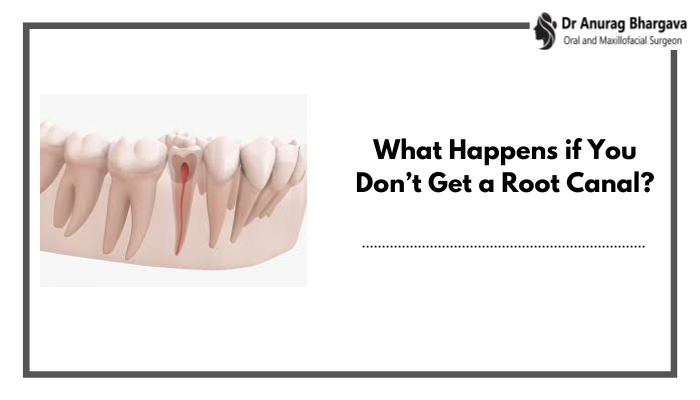 What Happens if You Don’t Get a Root Canal?