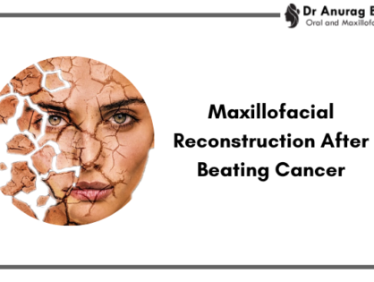 Maxillofacial Reconstruction After Beating Cancer | Restoring Hope