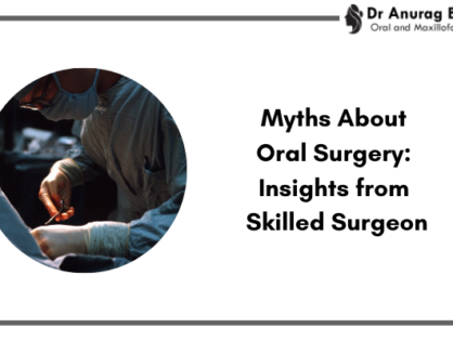 Debunking Myths About Oral Surgery: Insights by Skilled Surgeon