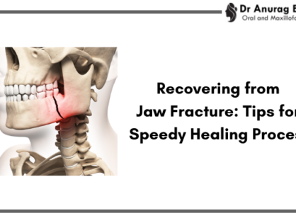 Recovering from Jaw Fracture: Tips for Speedy Healing Process