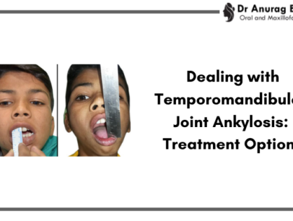 Dealing with Temporomandibular Joint Ankylosis: Treatment Options