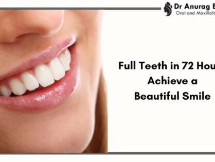 Full Teeth in 72 Hours: Achieve a Beautiful Smile Quickly