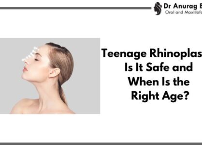 Teenage Rhinoplasty: Is It Safe and When Is the Right Age?