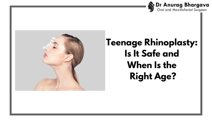 Teenage Rhinoplasty: Is It Safe and When Is the Right Age?