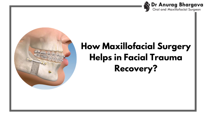 How Maxillofacial Surgery Helps in Facial Trauma Recovery?