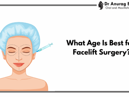 What Age Is Best for Facelift Surgery? Signs You May Be Ready