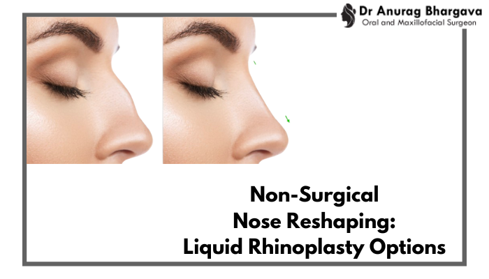 Non-Surgical Nose Reshaping: Exploring Liquid Rhinoplasty Options in Indore