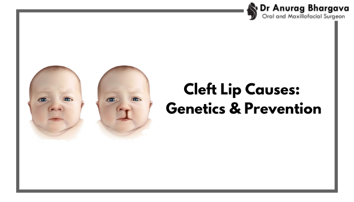 Cleft Lip Causes: Genetics, Environment and Prevention