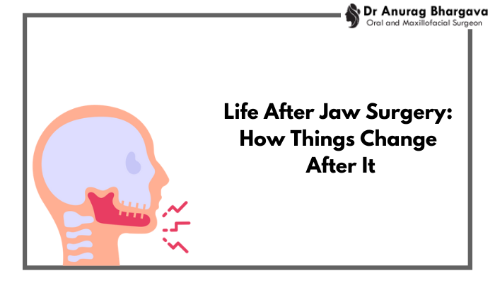 Life After Jaw Surgery: How Things Change After It