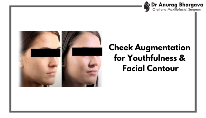 How Cheek Augmentation Enhances Youthfulness & Facial Contour