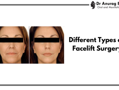 Different Types of Facelift Surgery: Which One Is Right for You?