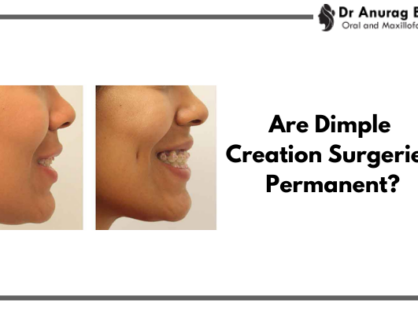 Are Dimple Creation Surgeries Permanent? Results & Longevity