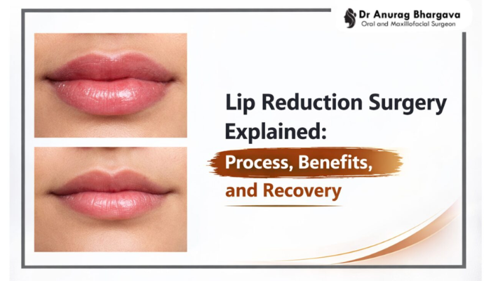 Lip Reduction Surgery by Facial plastic surgeon in indore