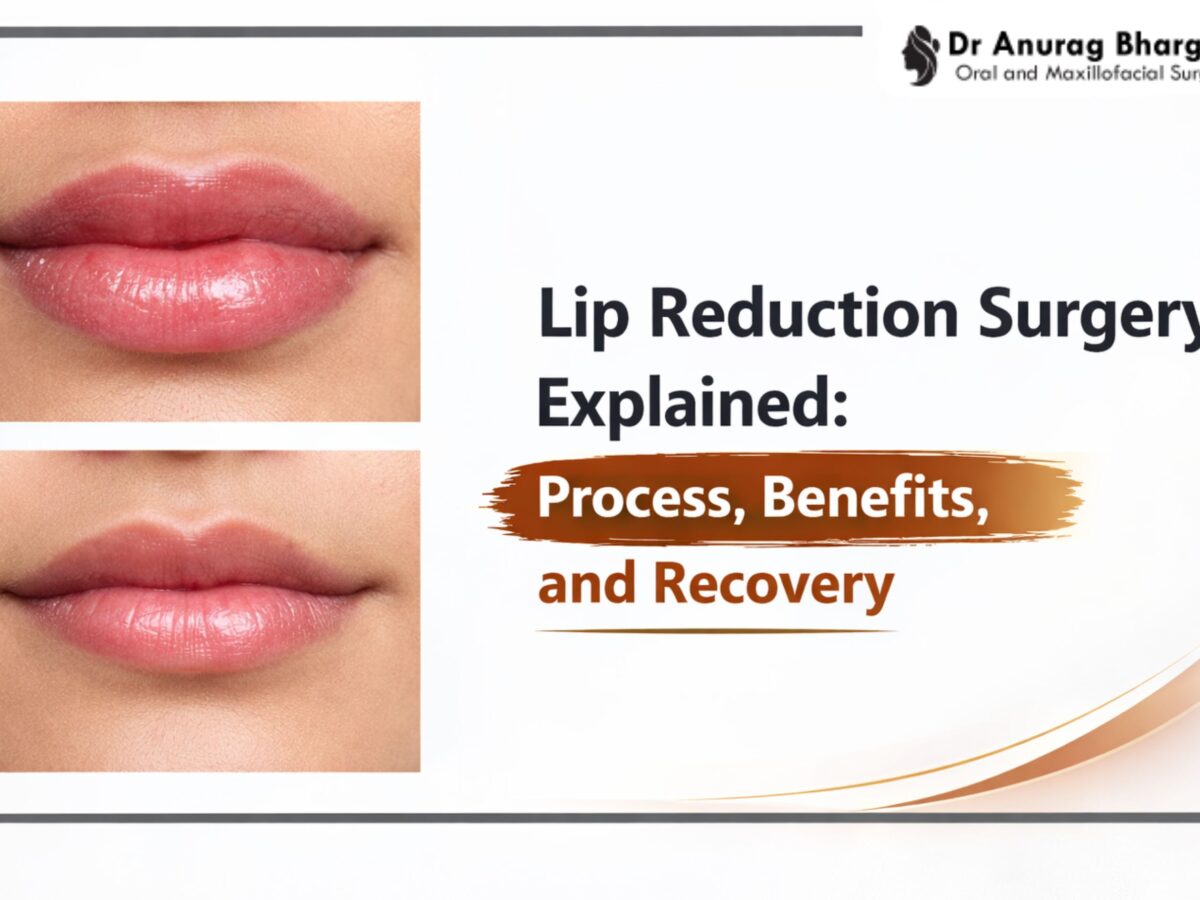 Lip Reduction Surgery Explained: Process, Benefits, and Recovery