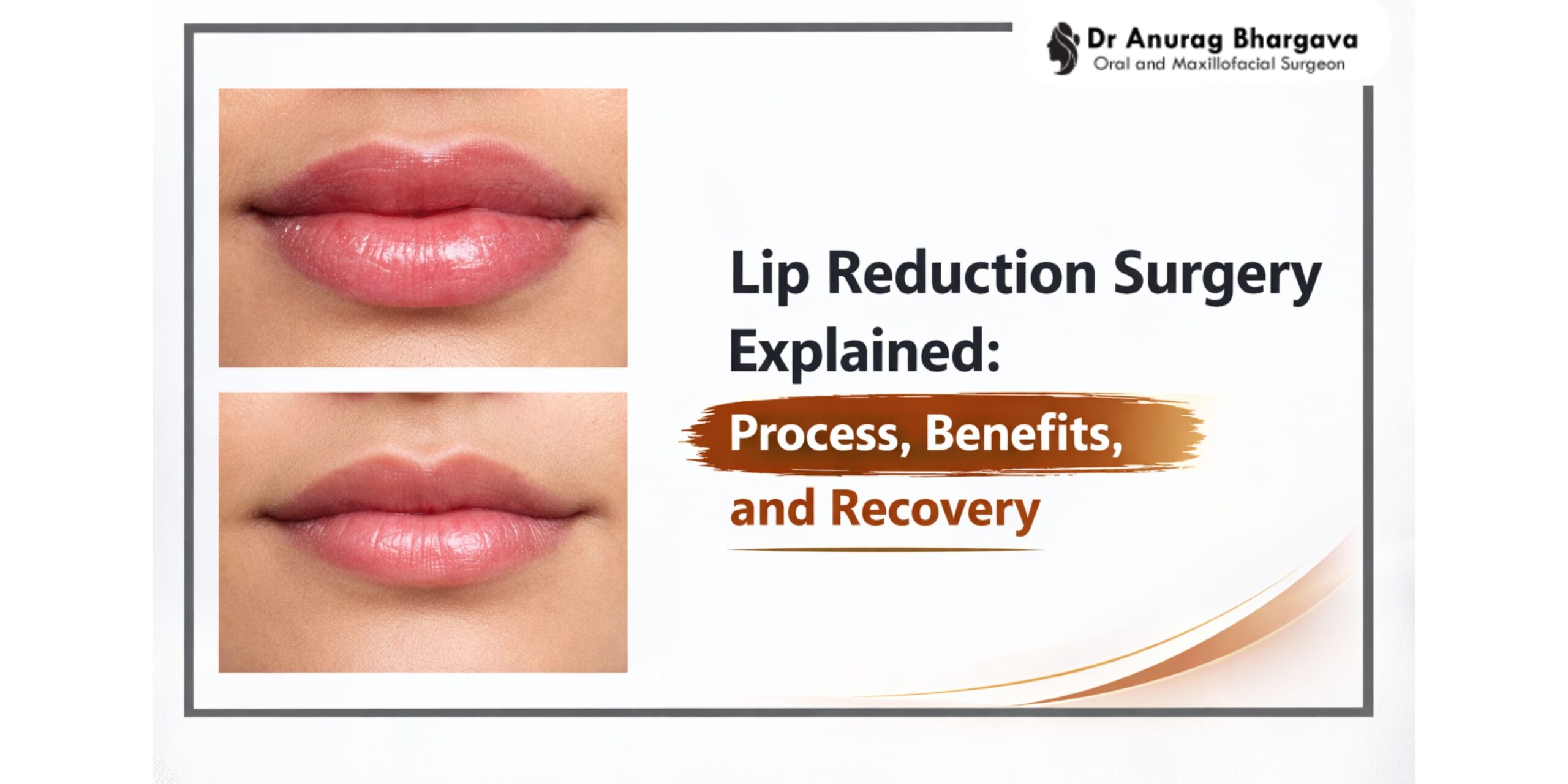 Lip Reduction Surgery Explained Process Benefits & Recovery