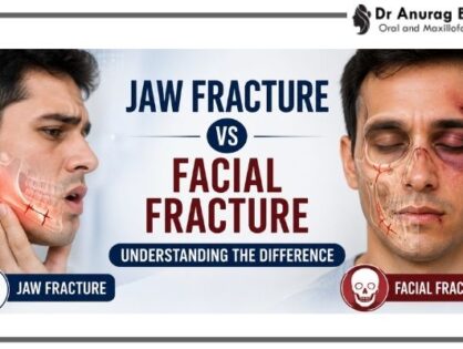 Jaw Fracture vs Facial Fracture: Understanding the Difference